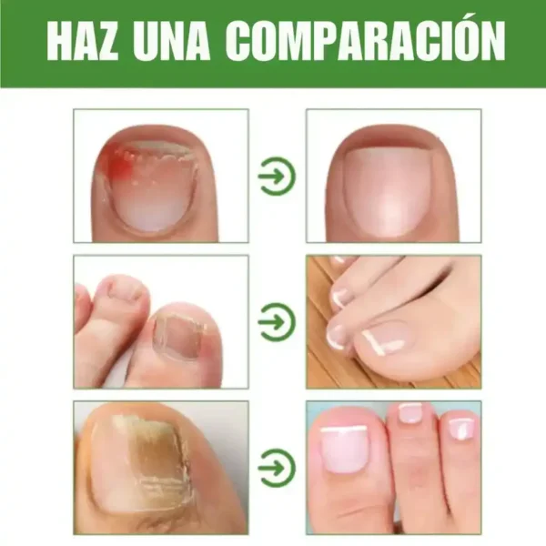 Roll-On Anti Hongos 7 días - Imagen 4