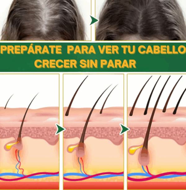 Spray Orgánico de Recuperación, Crecimiento y Control de Caída de Cabello - Imagen 2